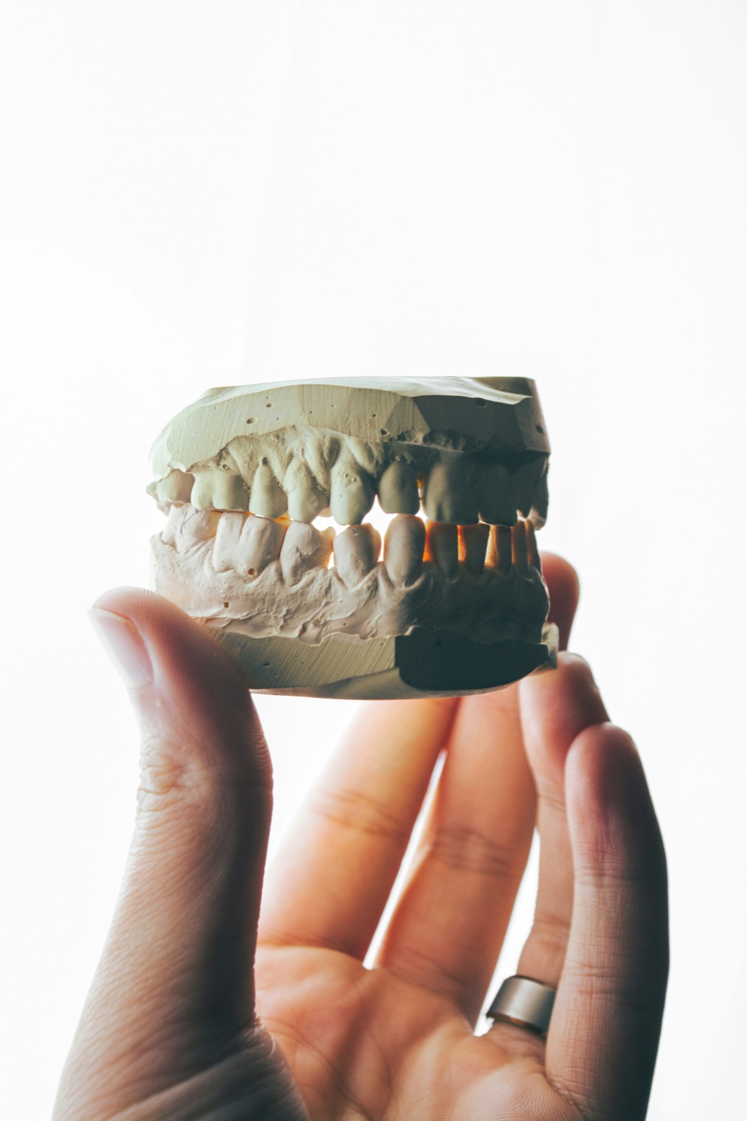 Modelo odontológico para planejamento ortodôntico